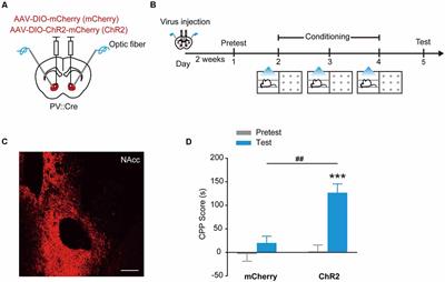 Parvalbumin Interneurons Determine Emotional Valence Through Modulating Accumbal Output Pathways